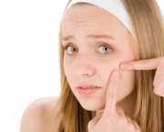 causas-da-acne-sintomas-e-como-tratar (1)