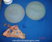 Cirurgias Plásticas Para Correção de Mamas Caídas (10)