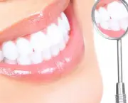 duvidas-comuns-sobre-clareamento-dentario (1)