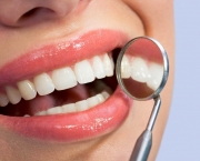 duvidas-comuns-sobre-clareamento-dentario (5)