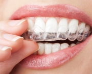 duvidas-comuns-sobre-clareamento-dentario (6)