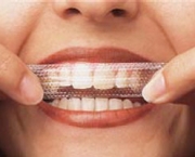 duvidas-comuns-sobre-clareamento-dentario (8)