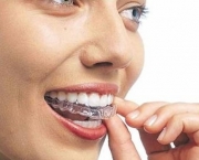 duvidas-comuns-sobre-clareamento-dentario (10)