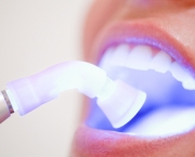 duvidas-comuns-sobre-clareamento-dentario (13)