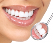 duvidas-comuns-sobre-clareamento-dentario (14)