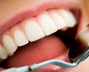 duvidas-comuns-sobre-clareamento-dentario (15)
