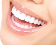 duvidas-comuns-sobre-clareamento-dentario (18)