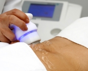tratamentos-esteticos-para-derreter-a-gordura-localizada (15)
