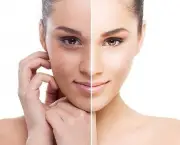 Benefícios do Peeling Facial (15)