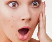 best-acne-scar-treatment-595x292