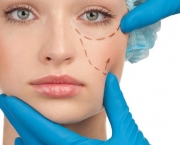 Cirurgia Plástica Estética (11)