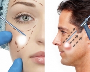 Cirurgia Plástica Facial (1)