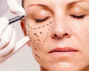 Cirurgia Plástica Facial (7)