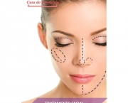 Cirurgia Plástica Facial (10)