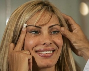 Cirurgia Plástica Facial (11)