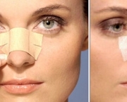 Cirurgia Plástica Facial (15)
