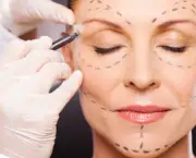 middle aged woman preparing for plastic surgery