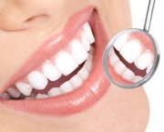 como-funciona-o-clareamento-dental-a-laser (1)