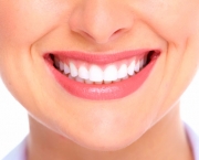 como-funciona-o-clareamento-dental-a-laser (4)