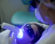 como-funciona-o-clareamento-dental-a-laser (17)