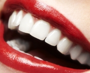 Dentes (3)