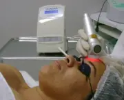 Tratamento-de-Pele-a-Laser