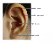 otoplastia-cirurgia-da-orelha (3)