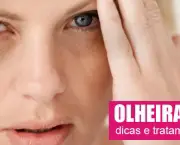 olheiras1